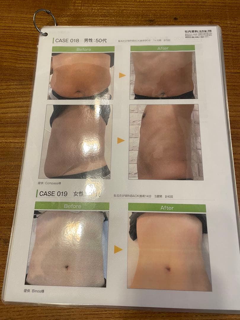 WINBACK 美容機器 ラジオ波マシン3SE