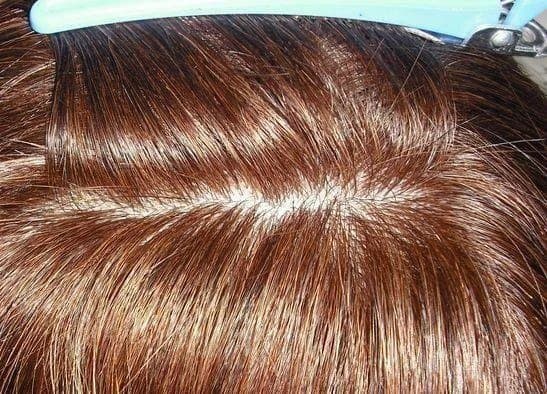 人毛　ウィッグ　人工皮膚付き　ブラウン　スーパーロング　Sサイズ