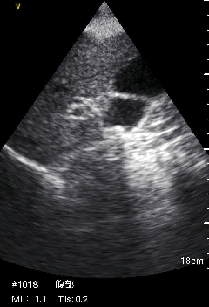 GE Vscan Extend 医療用モニタリング機器