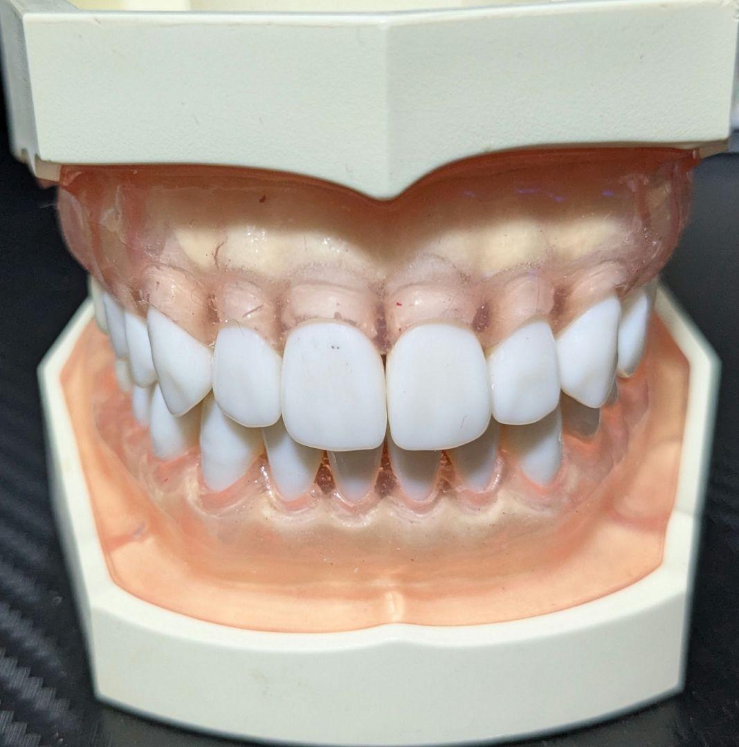 ニッシン　顎模型 複製歯牙着脱模型　実習用 舌、スタンド付き