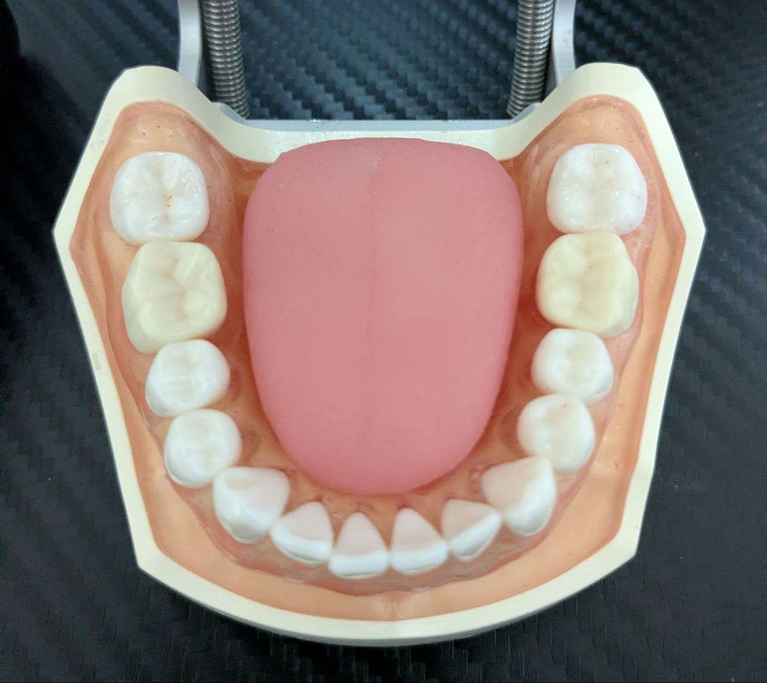 ニッシン　顎模型 複製歯牙着脱模型　実習用 舌、スタンド付き