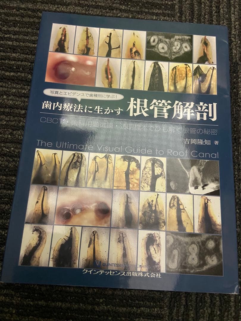 写真とエビデンスで歯種別に学ぶ! 歯内療法に生かす根管解剖