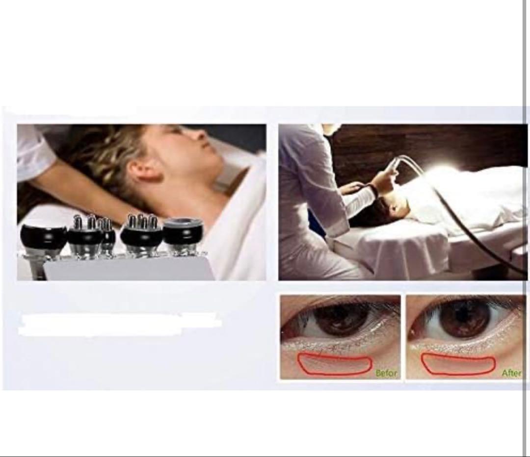 キャビテーション＋ラジオ+バキューム+キャビテーション マシン本体