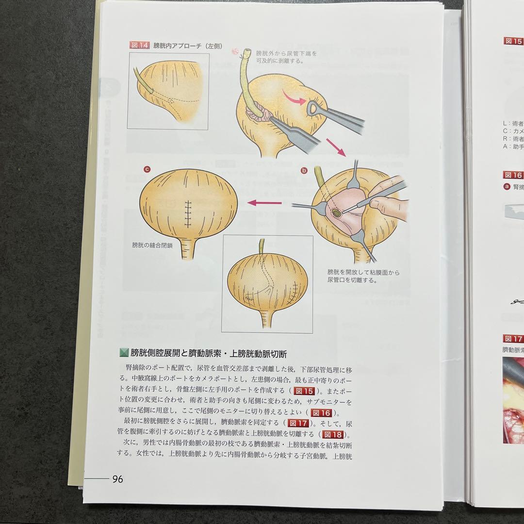 究める 腎・副腎腫瘍に対する腹腔鏡・ロボット支援手術