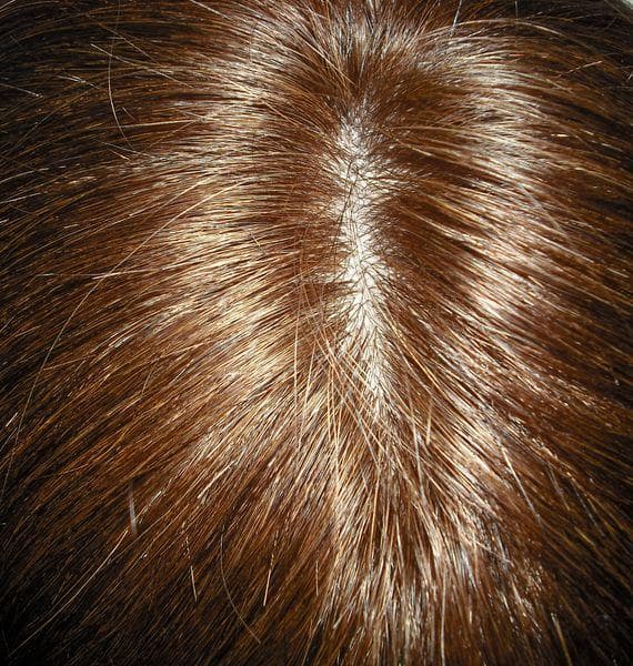 人毛　ウィッグ　幅広人工皮膚付き　ブラウン　スーパーロング　Ｍサイズ