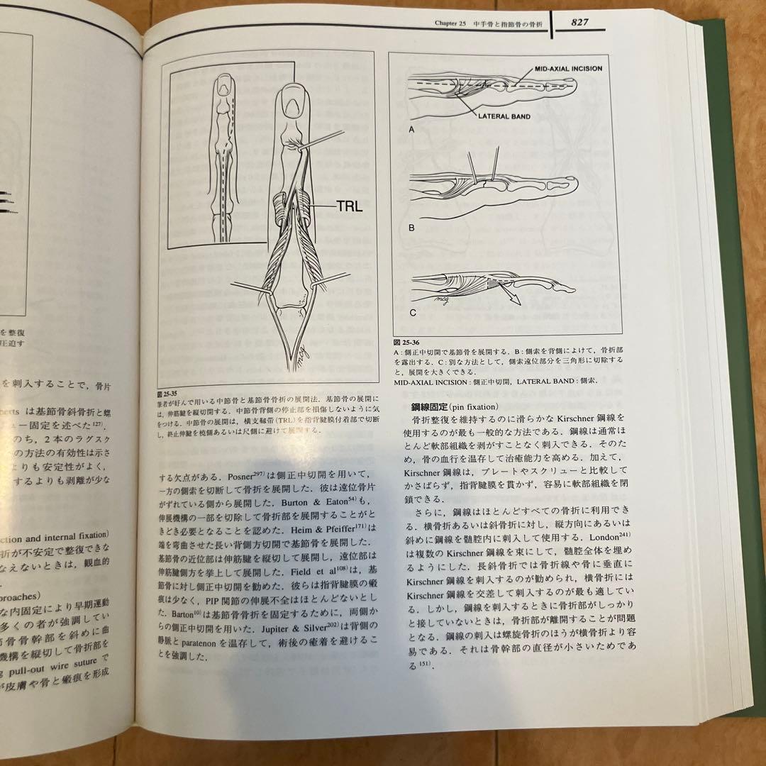 Greenの手の外科手術 日本語版　第4版 Vol. 1, 2