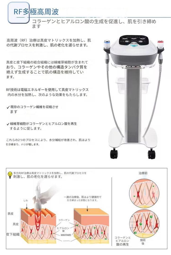 ♥♥ゆん♥♥！エレクトロポレーション RF美顔器　美容機器　美容液導入