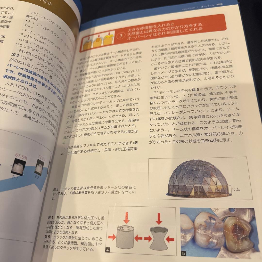 オーバーレイ修復 超入門