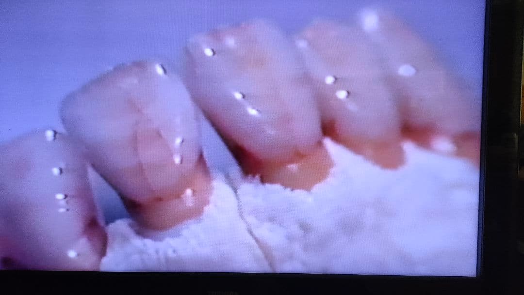 歯科技工　青嶋仁、片岡繁夫、ミューターティース 川崎従道デモビデオ　ポーセレン