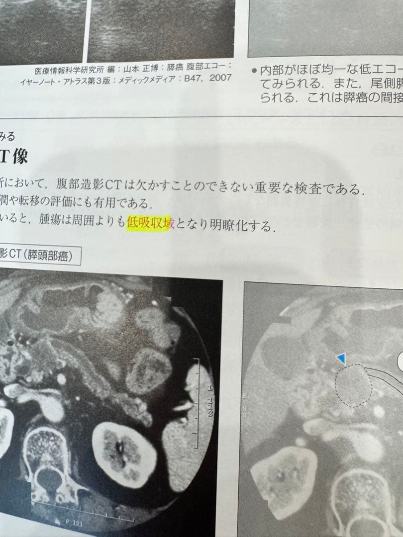 病気がみえる10冊セット　送料込
