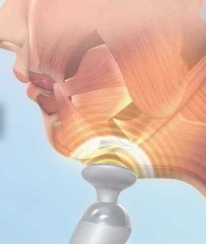 ルネサンス開発 StyllyFace EMS 美顔器　スタイリーフェイス