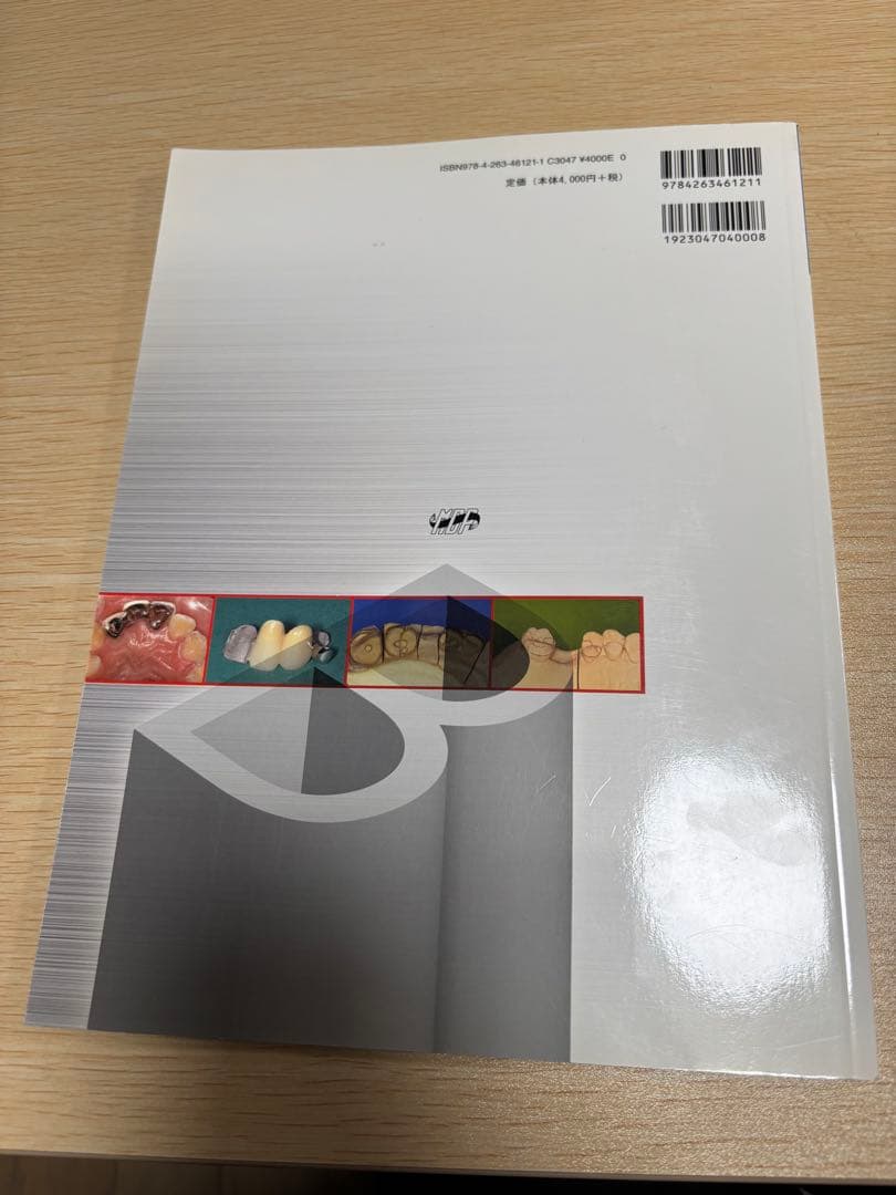 接着ブリッジ講座