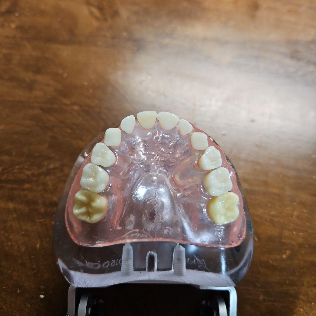 歯科模型 可動式
