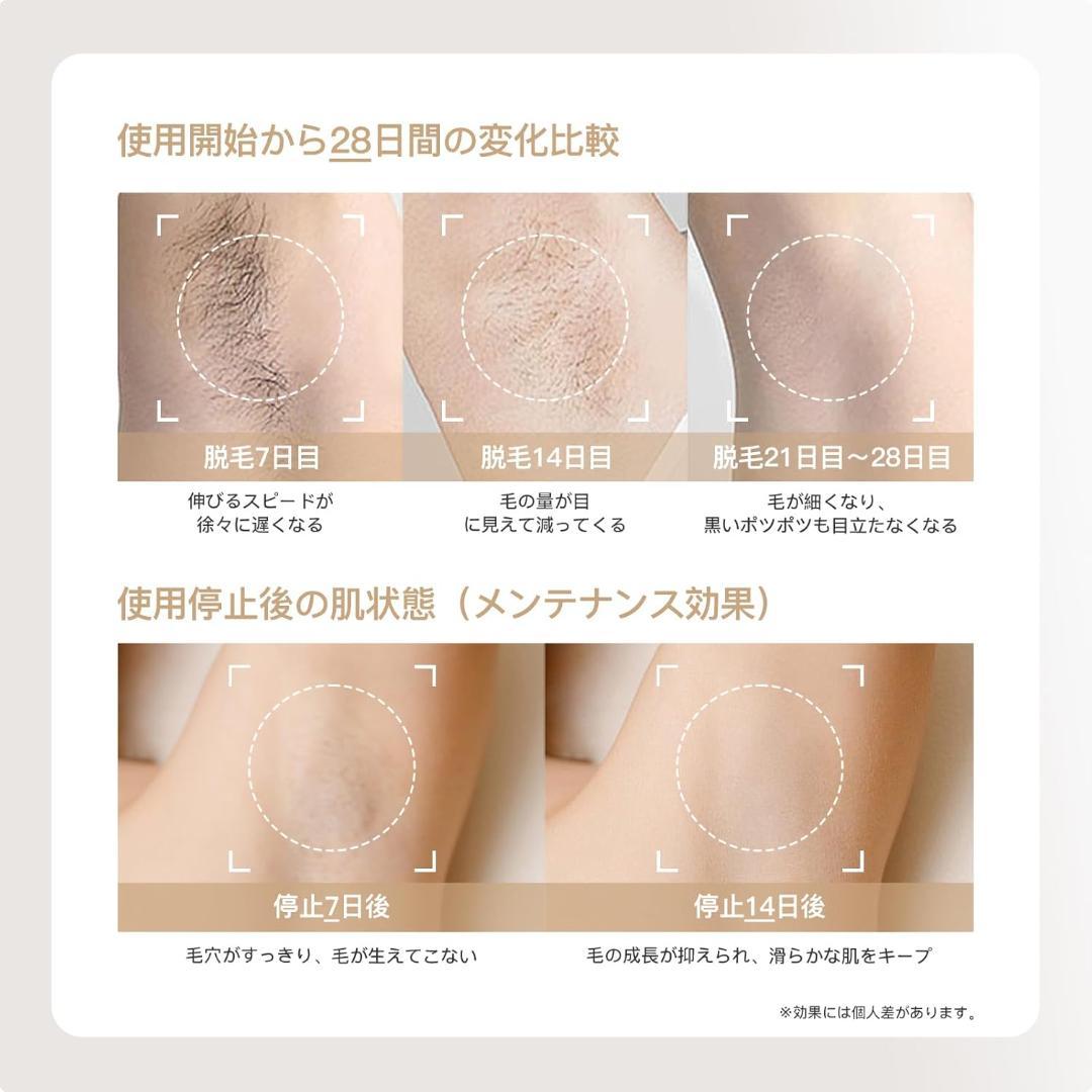 Yete エイティー 脱毛器 冷感 光脱毛器 IPL フラッシュ式
