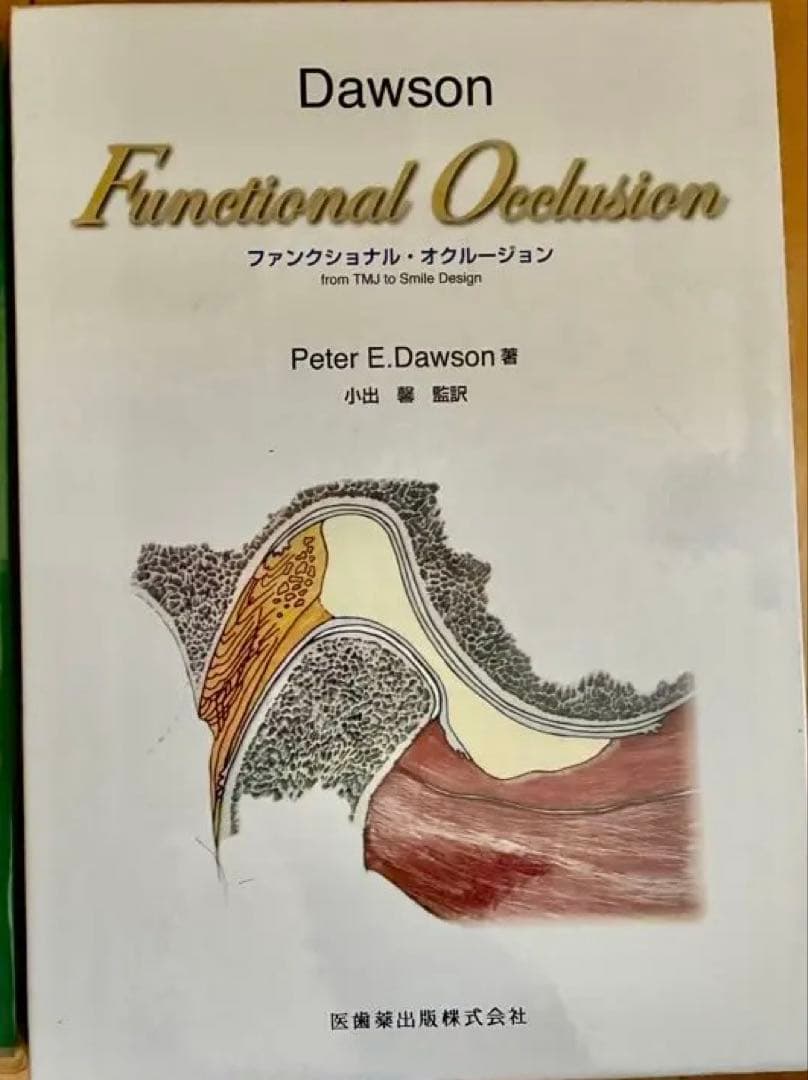 歯科　ファンクショナルオクルージョン