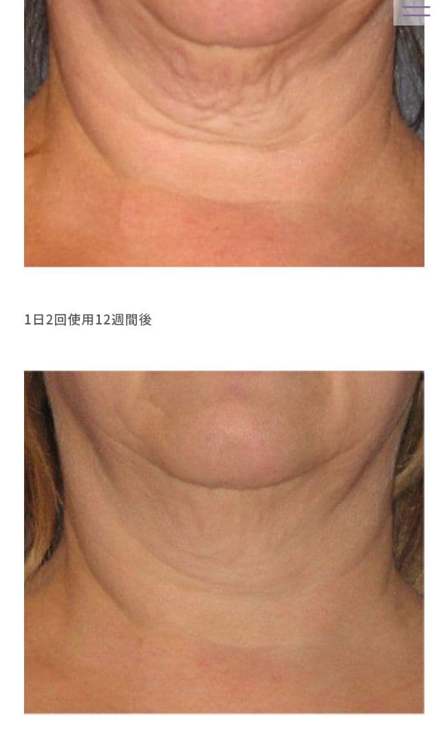 ネオストラータ スキンアクティブ トリプルファーミングネッククリーム