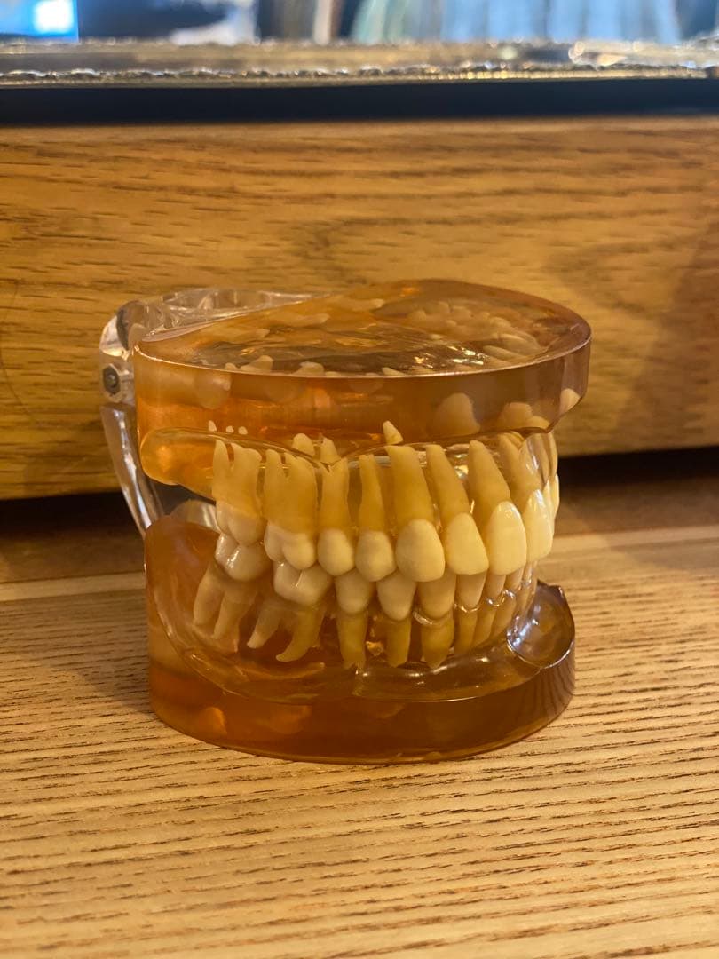 【ヴィンテージ／歯科模型】リアル歯列標本 レジン封入・希少インテリア 昭和レトロ