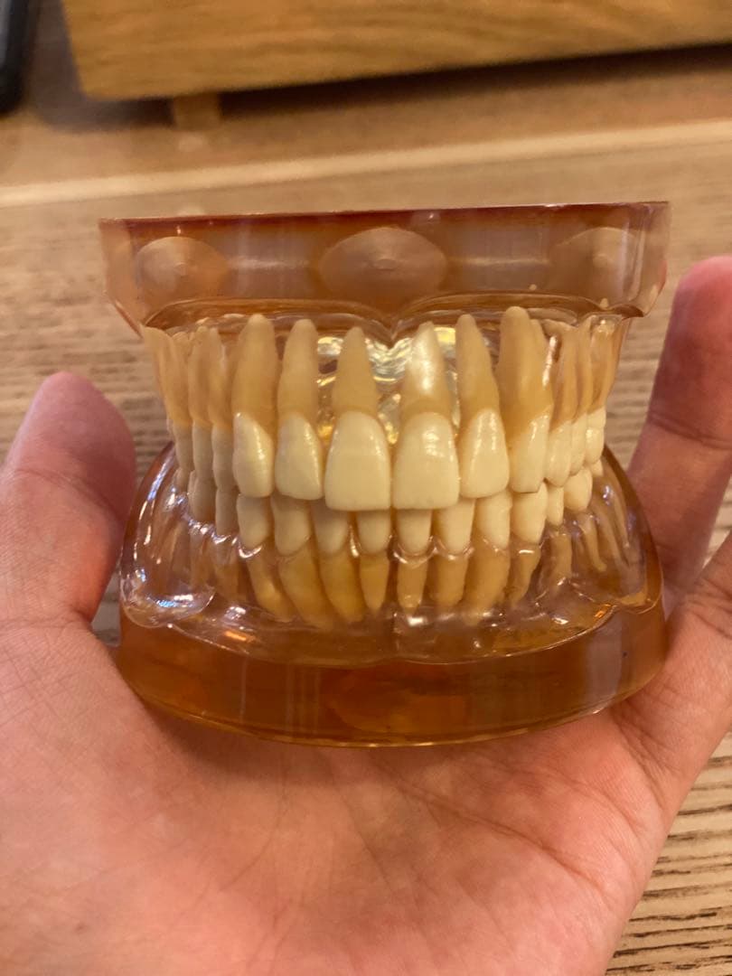 【ヴィンテージ／歯科模型】リアル歯列標本 レジン封入・希少インテリア 昭和レトロ