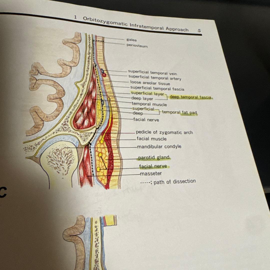 健康・医学 Surgical anatomy of the skull base