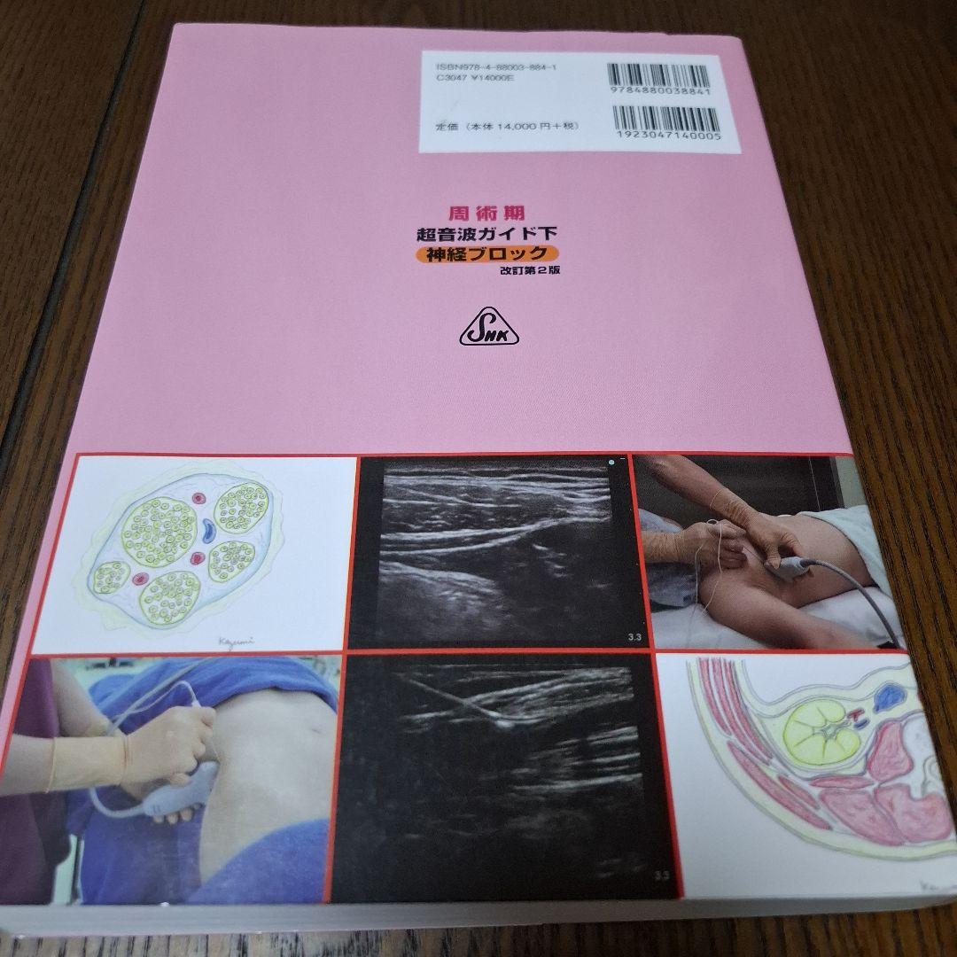 周術期超音波ガイド下神経ブロック