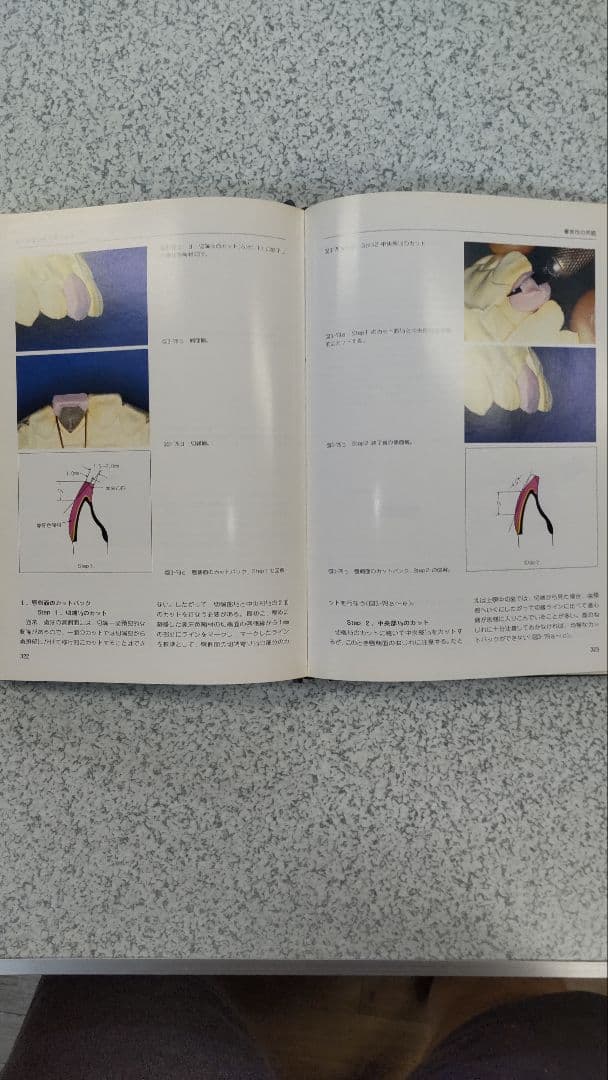 歯科技工 カラーアトラス「ザ・メタルセラミックス」変更しました