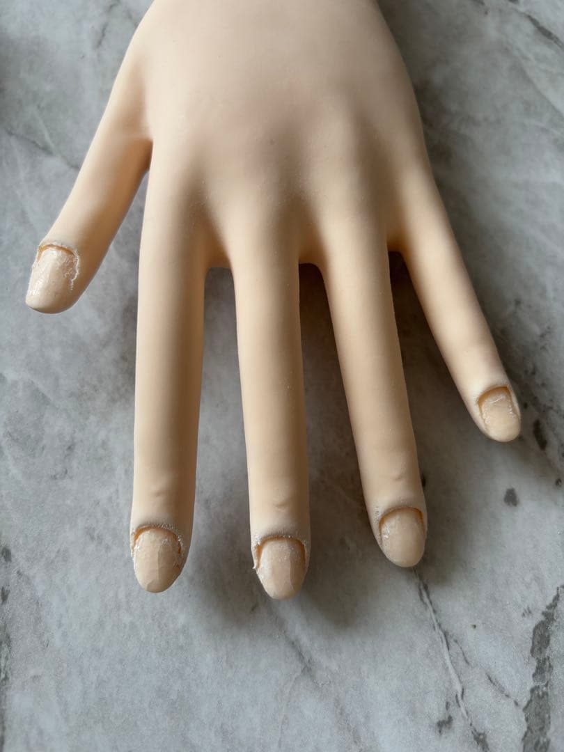 認定ハンド 両手 右手骨折2本有り