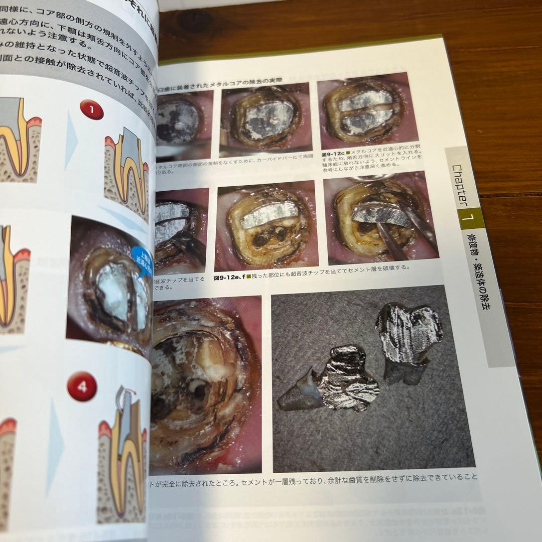 ビジュアル歯内療法学　生物学的コンセプトとテクニックのすべて