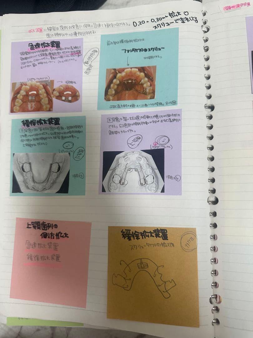 歯科衛生士付箋ノートまとめノート
