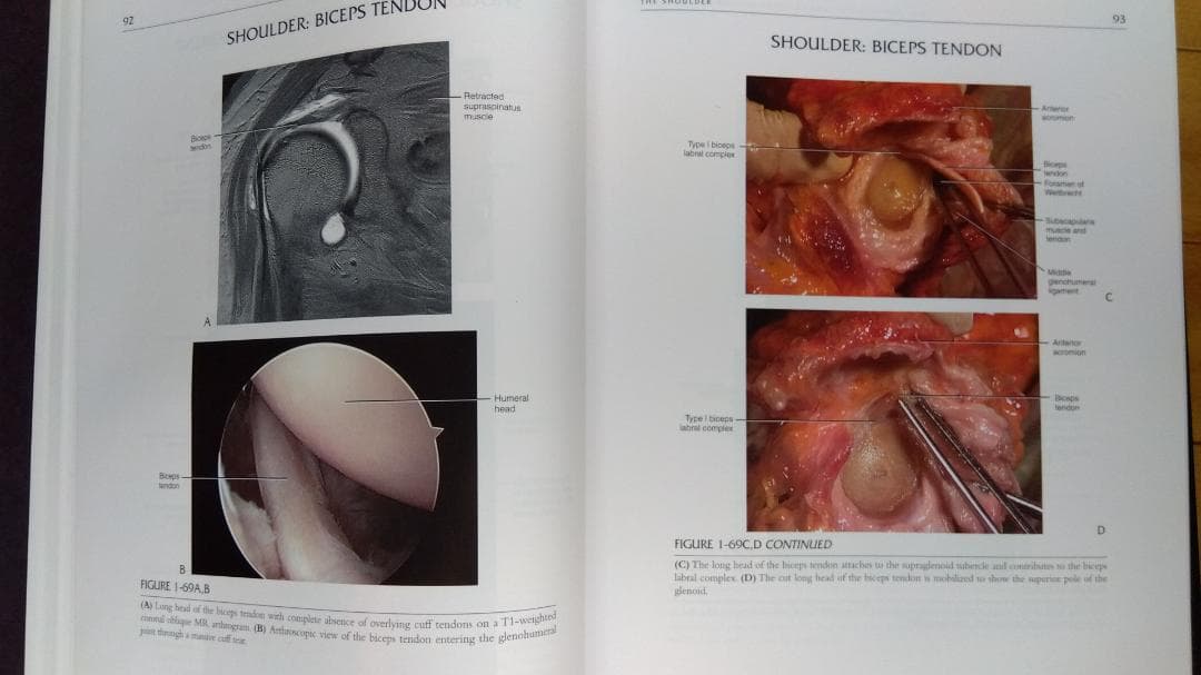 健康・医学 MRI ARTHROSCOPY and SURGICAL ANATOMY
