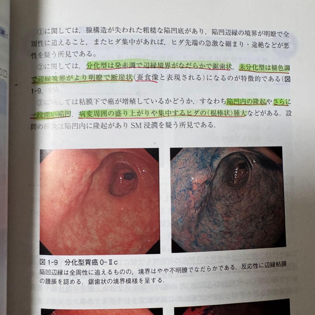 外科専門医 過去問題集 2021-2023 、演習問題と解説 第1集2集