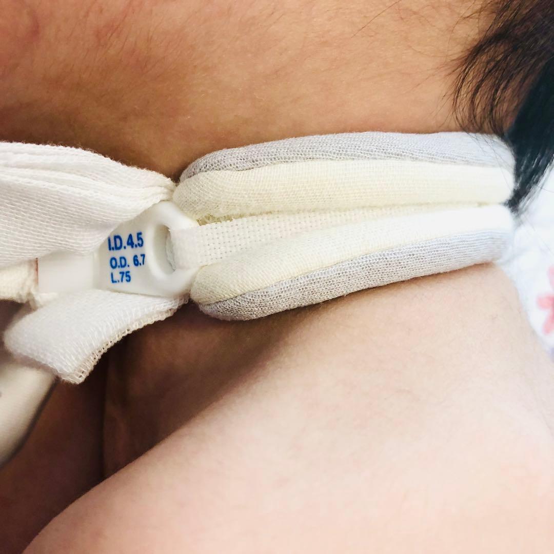 chitose211ページ　カニューレホルダー　カニューレバンド