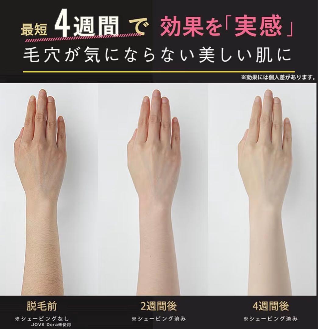 JOVS Dora SRモード脱毛器 新品未開封