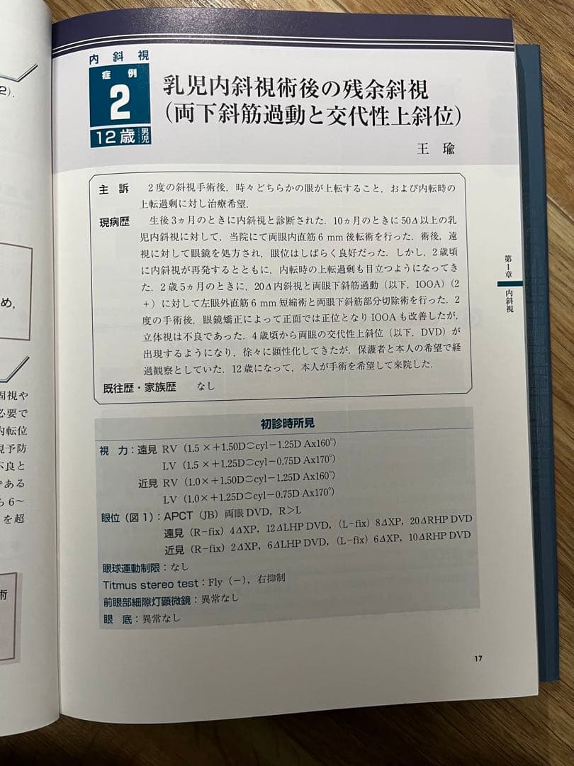 斜視治療のストラテジー