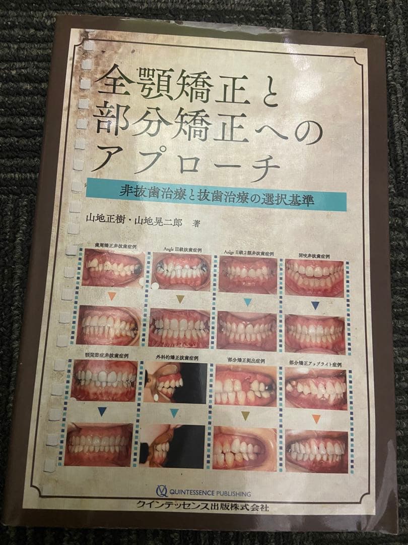 全顎矯正と部分矯正へのアプローチ : 非抜歯治療と抜歯治療の選択基準