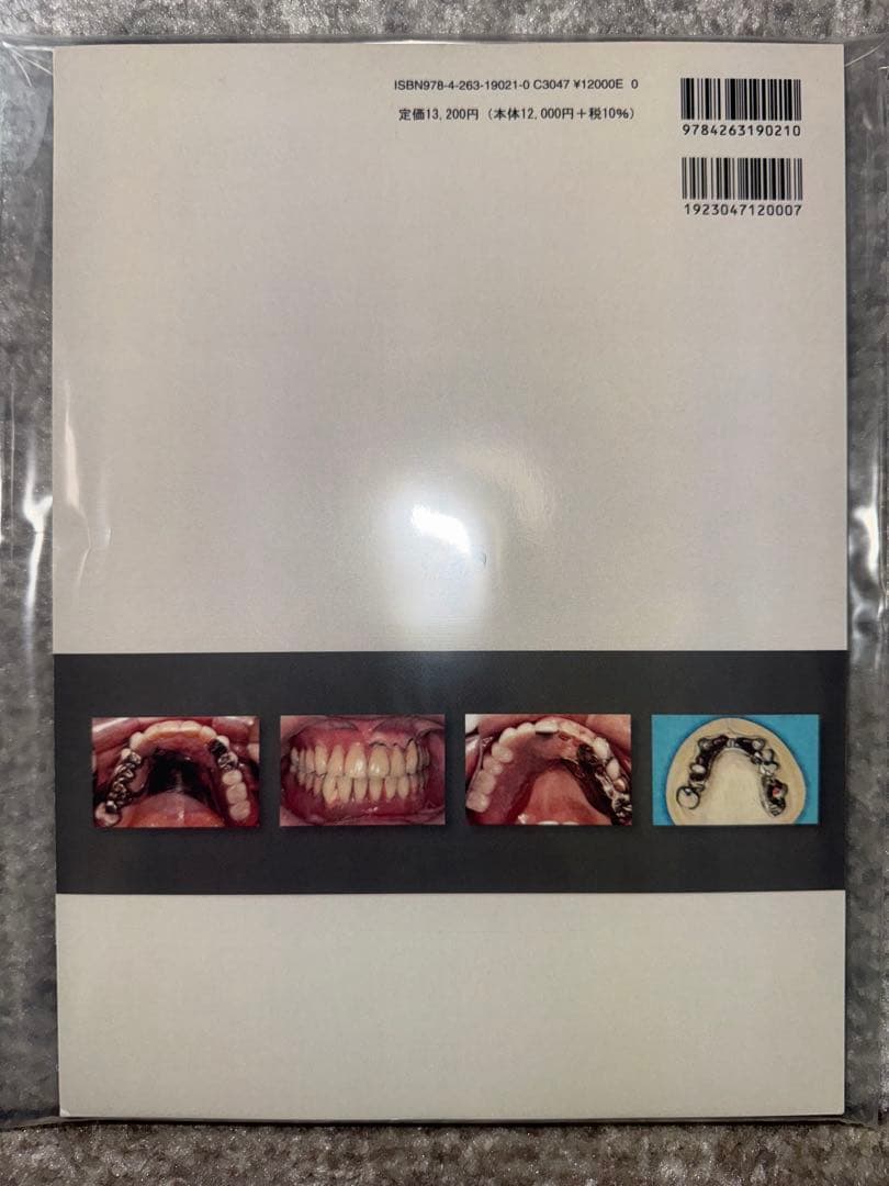 【裁断済み】症例でみる欠損歯列・欠損補綴　レベル・パターン・スピード