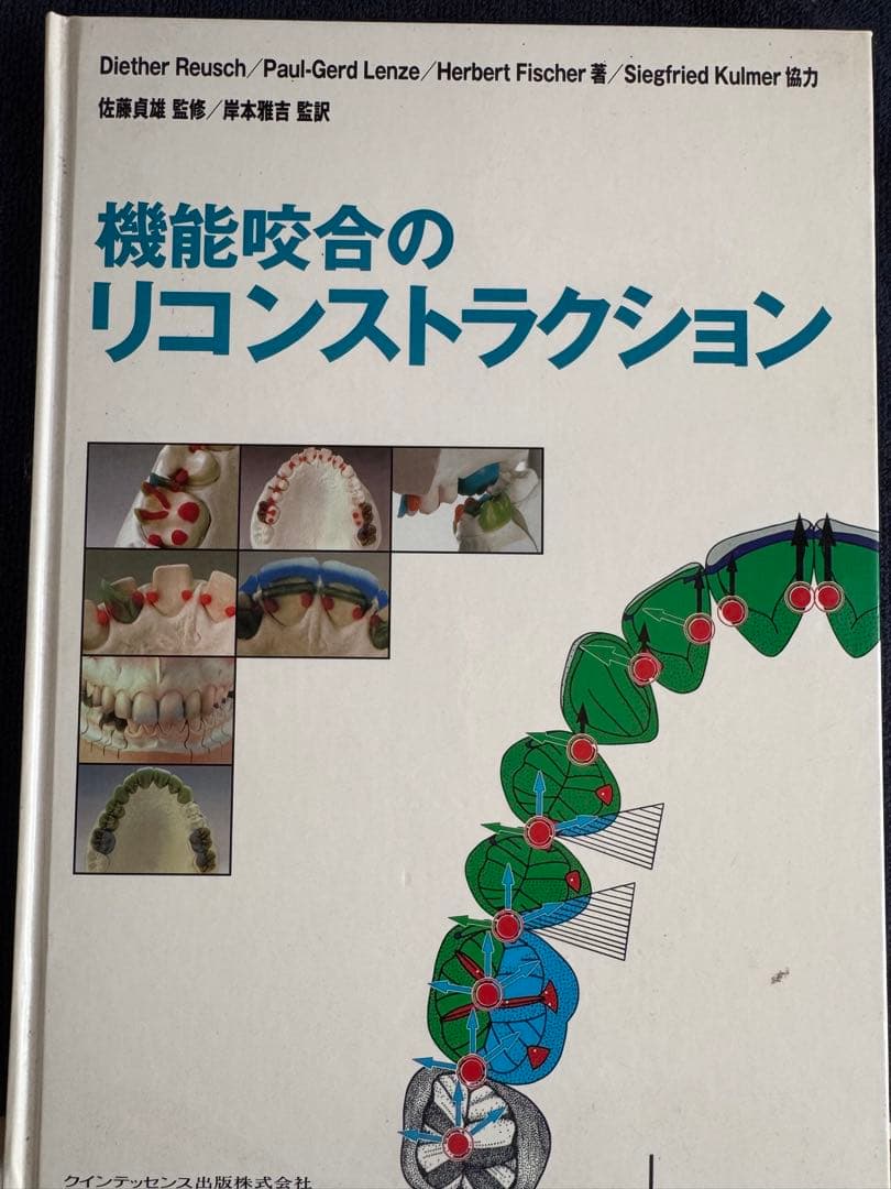 機能咬合のリコンストラクションSlavicek