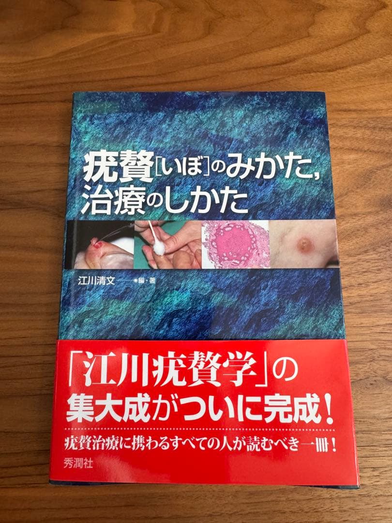 疣贅（いぼ）のみかた、治療のしかた