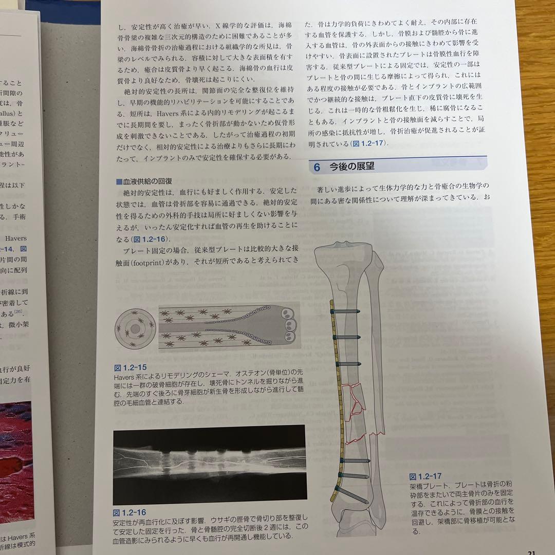 裁断済み　AO法　骨折治療　第3版