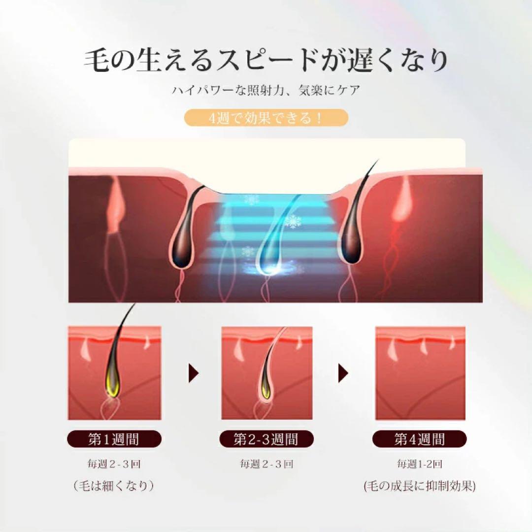 【最終値下げ】yete 脱毛器
