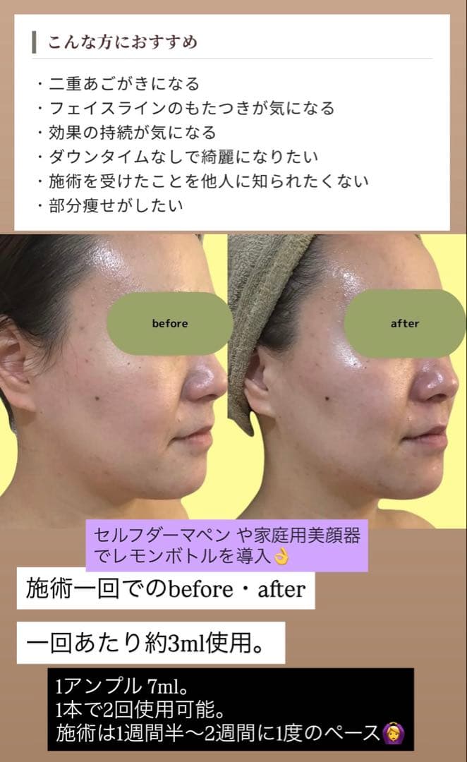 リヒラン　レモンボトル×３本